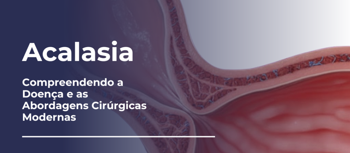 Acalasia Compreendendo a Doença e as Abordagens Cirúrgicas Modernas