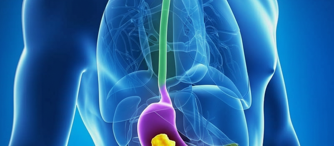 Gastrectomia Parcial no Tratamento do Câncer Gástrico_ Indicações, Benefícios e Recuperação